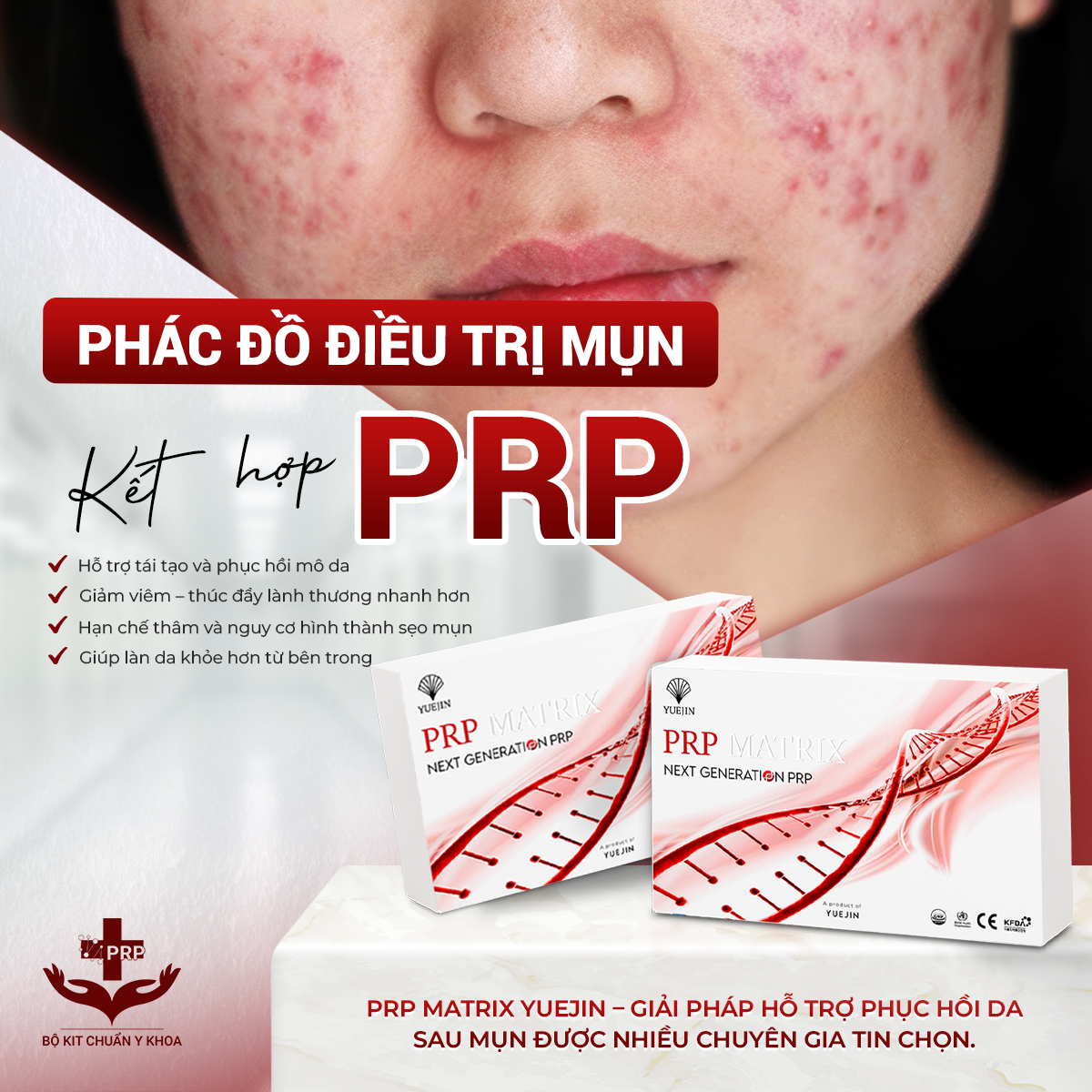 BỘ KIT PRP MATRIX YUEJIN 
