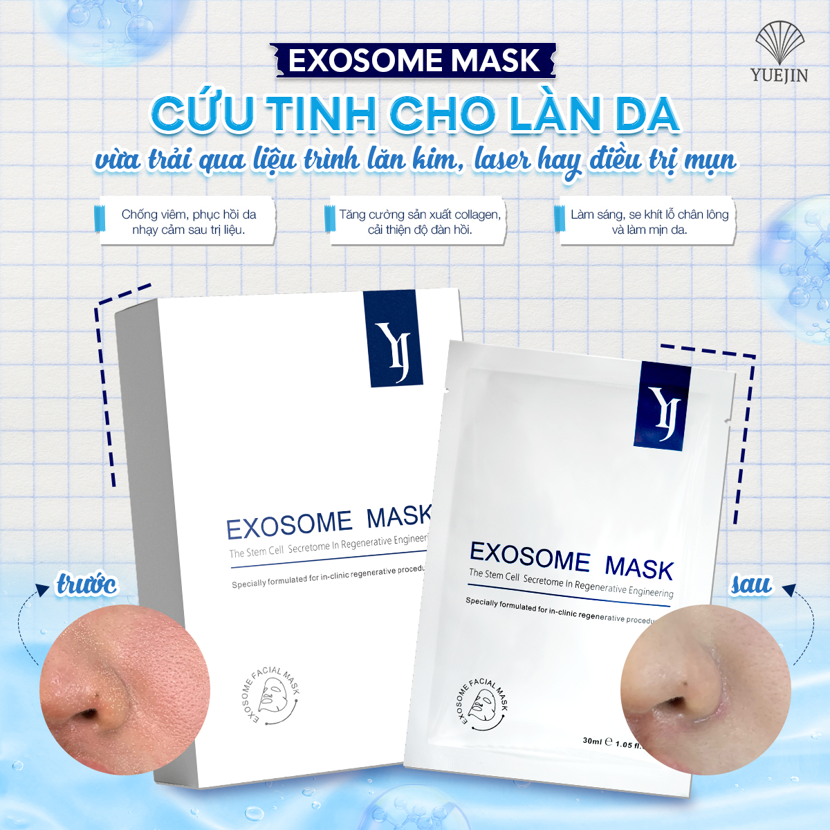 mat na Exosome phuc hoi da 4 1