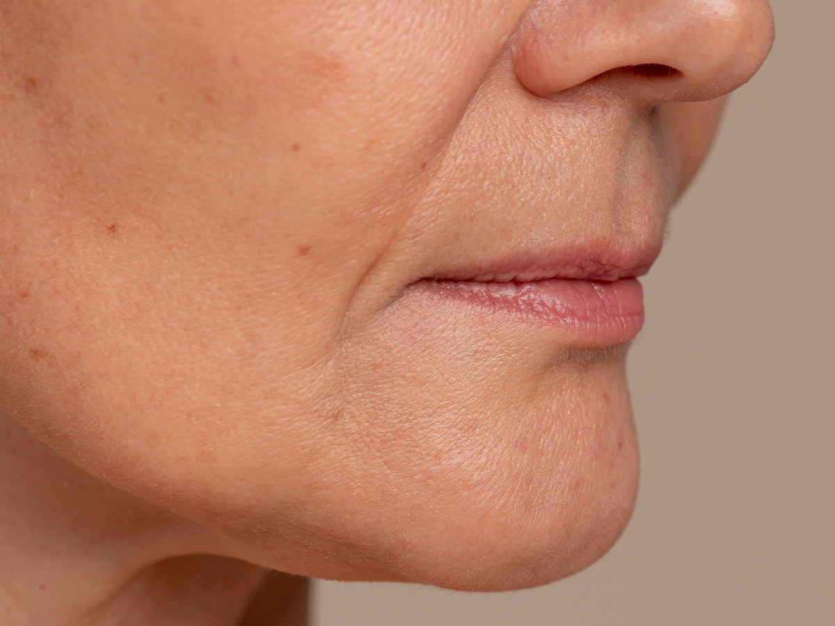 Lão hóa da là gì? Cách chống lão hóa 1 Mặt nạ Liposome Yuejin